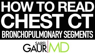 How to Read Chest CT Bronchopulmonary Segments [upl. by Arteid546]