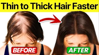 3 Best Home Remedies to Stop Hair Loss  Hair Growth Tips  Dandruff Removal [upl. by Terces]