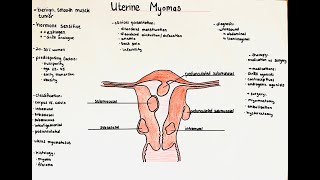 Uterine Myomas  definition histology classification clinics [upl. by Anek]