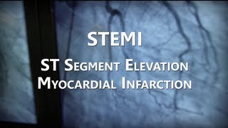 NHRMC Heart Center  STEMI Training Video [upl. by Adekam]