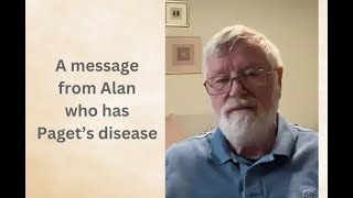 Alan has Pagets Disease of Bone He appeals for your help [upl. by Ravert8]