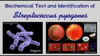 Pharyngitis Part 2 Bacterial Pharyngitis Streptococcus Pyogenes [upl. by Einneg493]