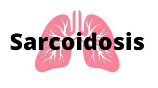 Sarcoidosis A Review rheumatology sarcoidosis [upl. by Khudari]