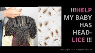 How to remove head lice on kids hair [upl. by Rafaela589]