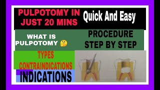 Pulpotomy PedodonticsTypes Of PulpotomyIndications amp ContraindicationsProcedures Of Pulpotomy [upl. by Ahsaz]