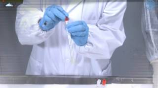 Sample collection in live birds blood tracheal and cloacal swat [upl. by Malva]