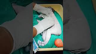 Newborn baby stomach wash umbilical cord cutting [upl. by Illek243]