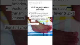 Chikungunya virus infection [upl. by Snook]