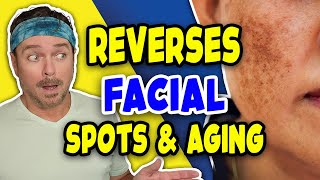 Ancient Skin Care Oils Stop Face Aging Issues  Age Spots Brown Patches amp Wrinkles  Chris Gibson [upl. by Aldredge]