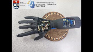 Myoelectric Prosthesis Control with Deep Learning [upl. by Hildebrandt]