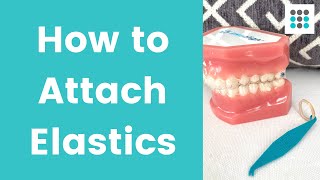 HOW TO PUT ELASTICS ON CLEAR ALIGNERS l Dr Melissa Bailey [upl. by Doownyl]