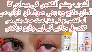 Moxigan amp femicon eye drops uses in urdu l best for eyes infection and itching by aneespharmacist [upl. by Annais]