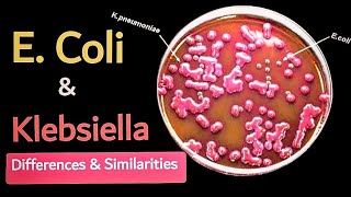 Difference between E coli and Klebsiella 🧫 lactose fermentor enterobacteriaece 🔬 [upl. by Wassyngton69]