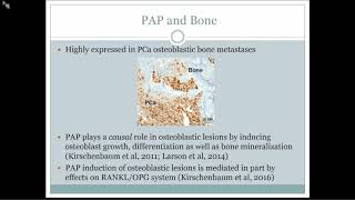 Prostate Cancer Osteoblastic Bone Metastases [upl. by Annahtur]