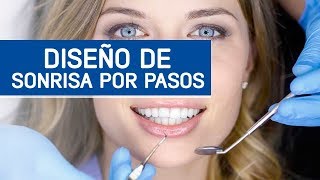 Diseño de Sonrisa paso a paso [upl. by Cornela]