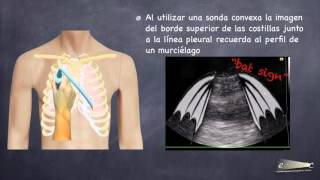 ECO PULMONAR [upl. by Negriv]