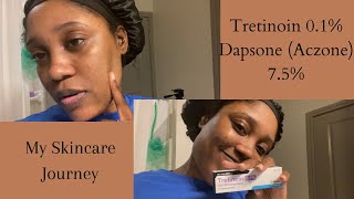 Starting My Skincare Journey  Tretinoin  Dapsone Aczone [upl. by Agan580]