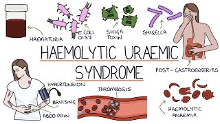 Haemolytic Uraemic Syndrome [upl. by Sorcim656]