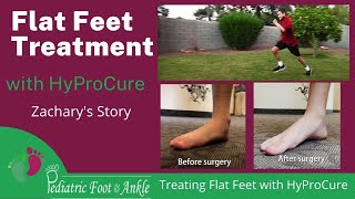 Flat Feet Correction with HyProCure Surgery Zacharys Story [upl. by Ban]