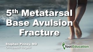 5th Metatarsal Base Avulsion Fracture [upl. by Meredi]