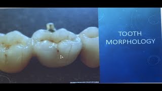 Tooth Morphology [upl. by Stanwood726]