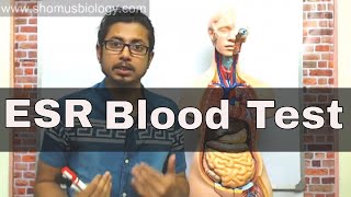 ESR test in Hindi erythrocyte sedimentation rate test [upl. by Siouxie784]