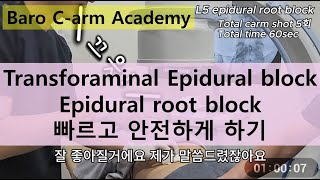 01 TFEB Transforaminal Epidural Block L5 신경차단술 방법 [upl. by Enelram]