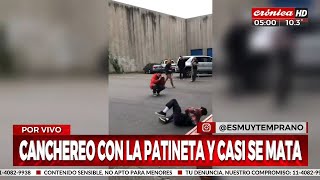 Quiso demostrar sus habilidades con la patineta ¡Y mirá cómo quedó [upl. by Ten448]