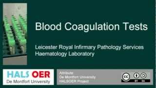 Automated Blood Analyser Part 6 CoagulationTest [upl. by Ross881]