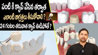 Precautions to Take After Dental Capping  When To Remove Dental Crowns  Way2Health [upl. by Oicanata]