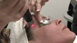 PicoSure Laser Skin Rejuvenation [upl. by Akirehc]