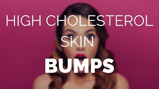 High cholesterol skin bumps and how to easily remove them [upl. by Aekal]