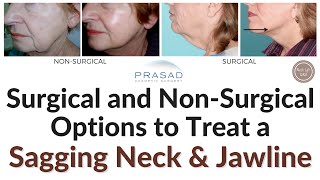 How to Treat Sagging Neck Chin and Jawline  Surgical to NonSurgical Options [upl. by Inaoj]