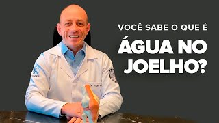 VOCÊ SABE O QUE É quotÁGUA NO JOELHOquot DrANDRÉ KRUEL [upl. by Ingles]