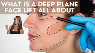 What is a deep plane face lift all about [upl. by Anyale]