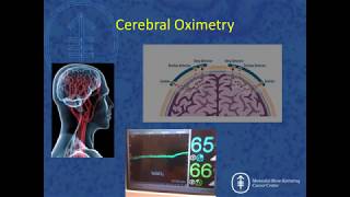 Smart Monitoring Part 1 of 2  The Future of Predictive Algorithms Dr Gregory Fischer [upl. by Ivatts244]