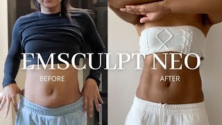 Emsculpt Neo  Before amp After Honest Opinion [upl. by Alyel]