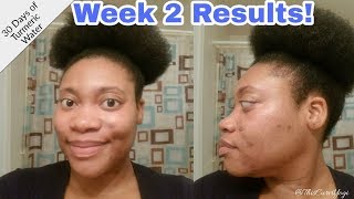 30 Days of Turmeric Water  Week 2 Results [upl. by Sherer]