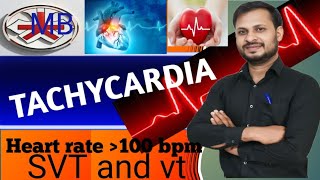 HOW TO READ ECG IN TACHYCARDIA and SUPRAVENTRICULAR TACHYCARDIA AND VENTTICULAR TACHYCARDIA [upl. by Roeser876]