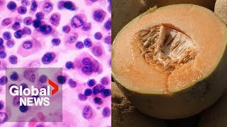 Salmonella poisoning symptoms What to watch out for as cantaloupelinked outbreak kills 5 in Canada [upl. by Yirinec]