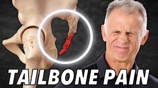 Top 5 SelfTreatments for Tailbone Coccyx Pain or Coccydynia [upl. by Irpak22]