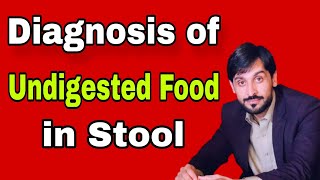 Undigested Food in Stool Causes amp Diagnosis  MLT Hub with kamran [upl. by Reel206]