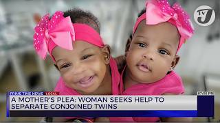 A Mothers Plea Woman Seeks help to Separate Conjoined Twins  TVJ News [upl. by Aliled]