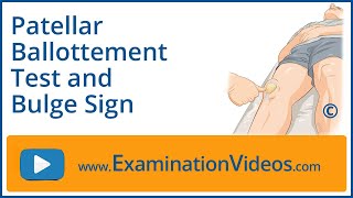 Patellar Ballottement Test and Bulge Sign [upl. by Iridis]