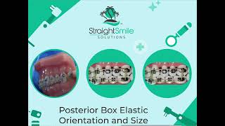 Posterior Box Elastics Size and Strength [upl. by Len]