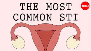 The most common STI in the world  Emma Bryce [upl. by Jase]