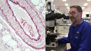 Microscope tutorial  Troubleshooting elastin stains  Part 2 [upl. by Igiul]