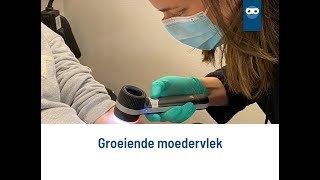 groeiende moedervlek [upl. by Peisch787]