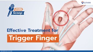 Effective Treatment for Trigger Finger  Vejthanis Scoop [upl. by Sonnnie]