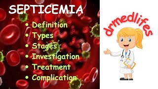 septicemia sepsis types stages investigation treatment complications [upl. by Sergei]